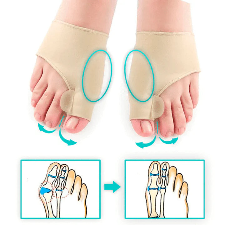 QuiroPie® l Corrector de Juanetes (PAR)
